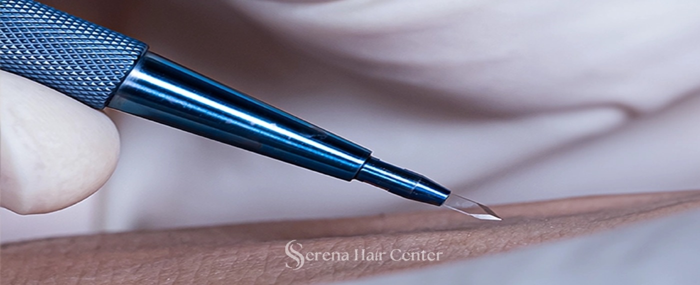 Sapphire FUE, FUE, Hair transplant, FUE sapphire hair transplant